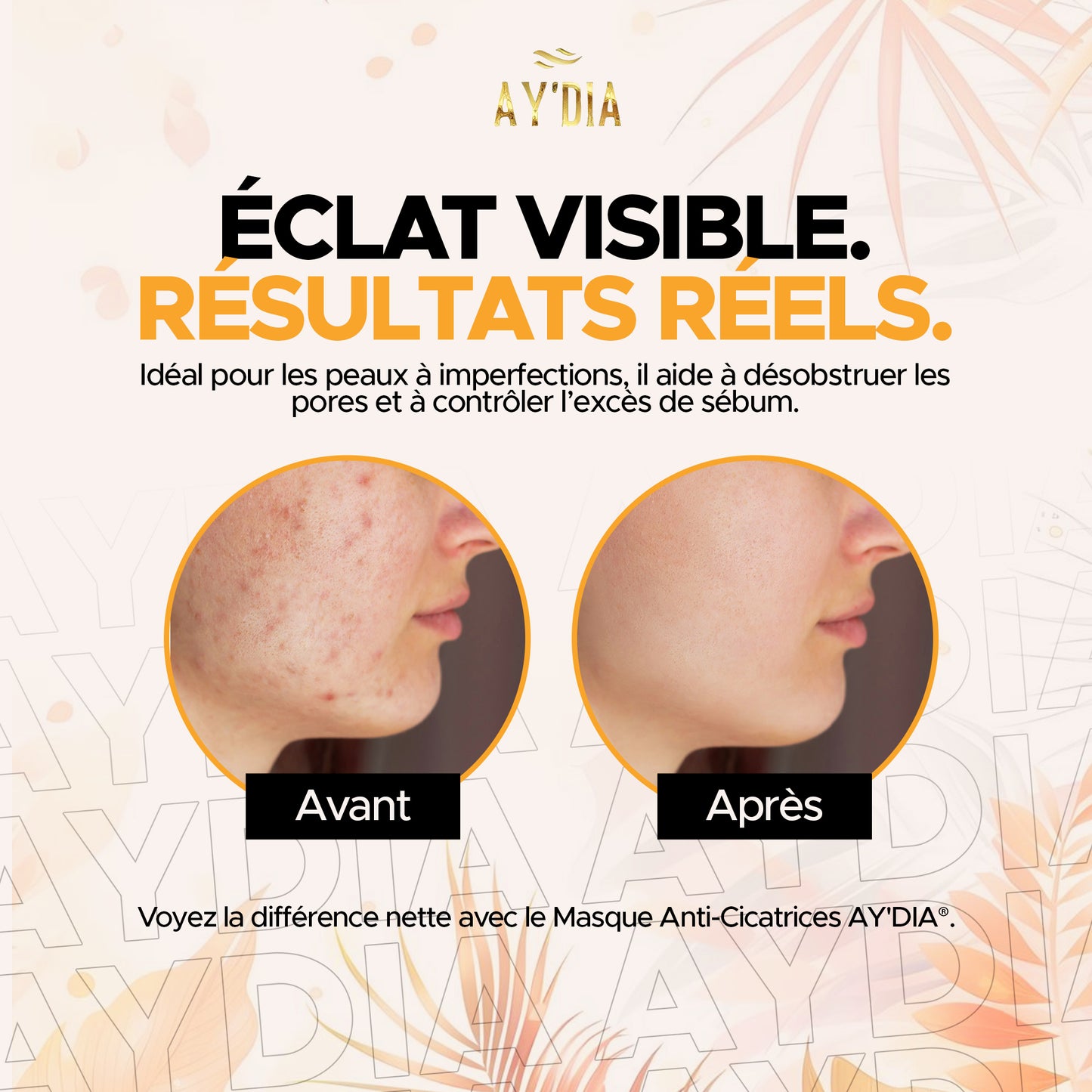 Masque Détox au Curcuma & Argile - Anti-Taches et Cicatrices AY’DIA®