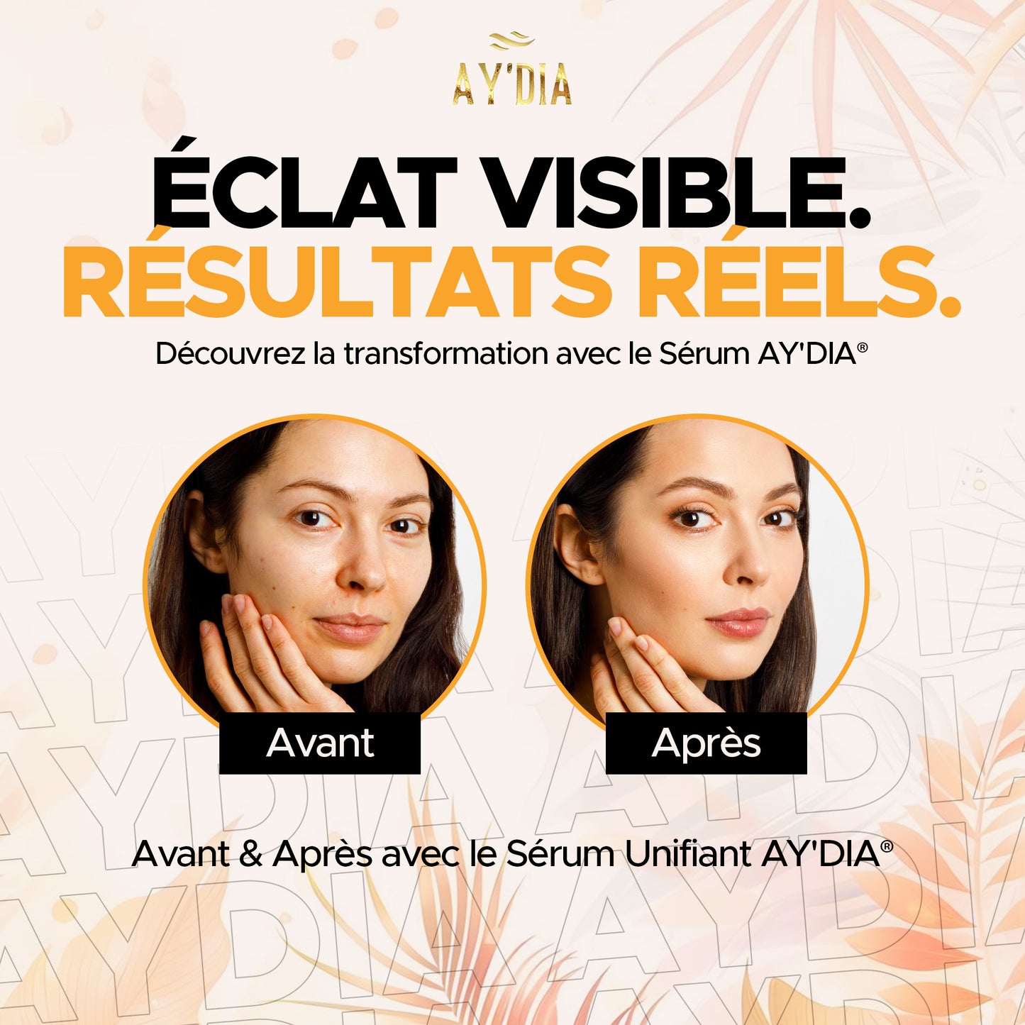 AY'DIA® Suero concentrado antimanchas e imperfecciones