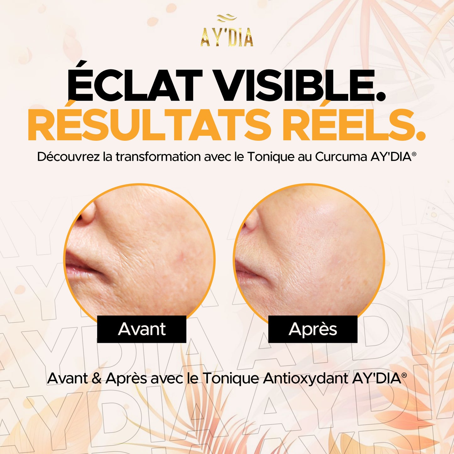 Toner Purifiant au Curcuma - Anti-Rougeur & Pores Resserrés AY'DIA®