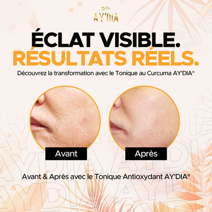 Toner Purifiant au Curcuma - Anti-Rougeur & Pores Resserrés AY'DIA®