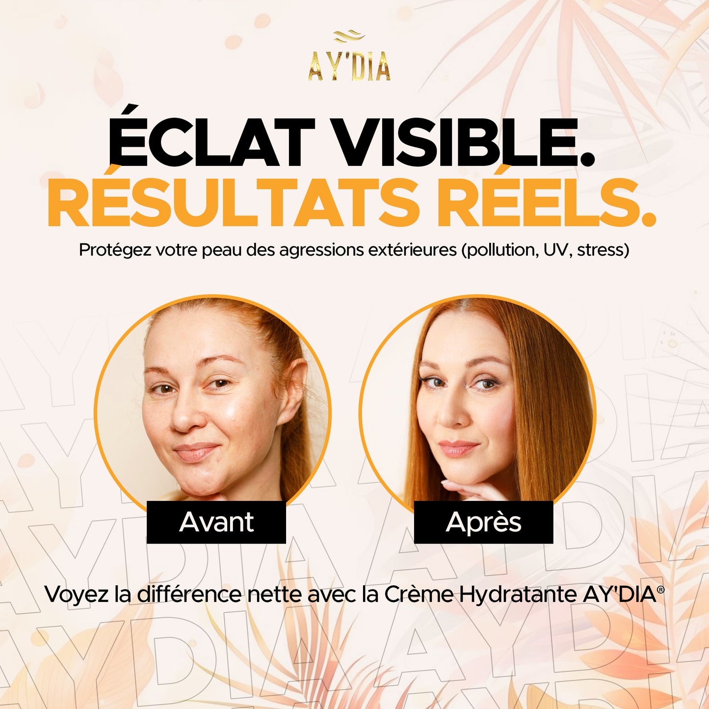 Crème Hydratante Unifiante - Anti-Cicatrices & Sébum AY'DIA®