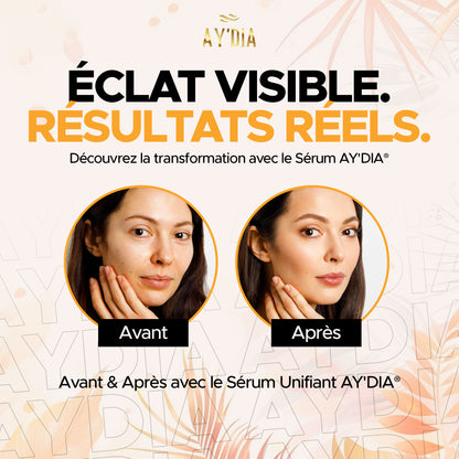 Sérum Concentré Anti-Taches & Imperfections AY’DIA®